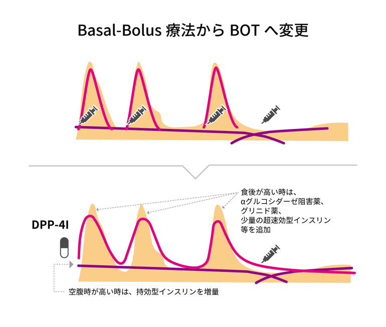 Basal-Bolus療法からBOTへ変更